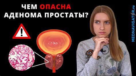 Удаление простаты: суть, причины и эффекты