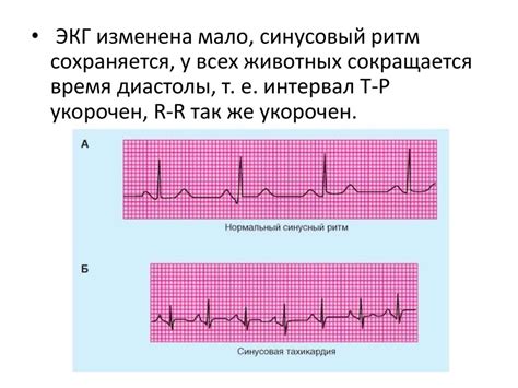 Укороченный интервал pq у ребенка 6 лет