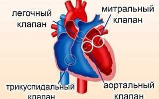 Уплотнение створок митрального клапана