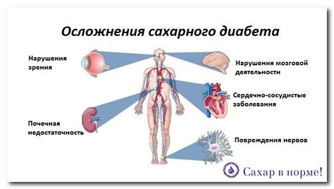 Управление психологическим состоянием при несахарном диабете