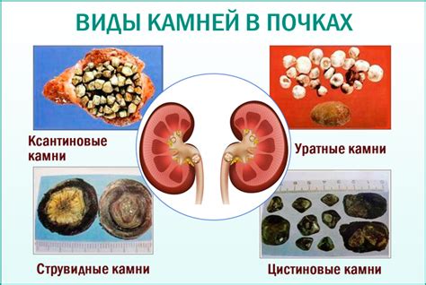 Ускоренное старение почек из-за простудной инфекции