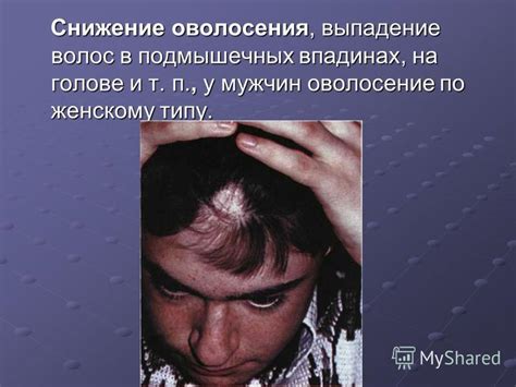 Устранение оволосения по женскому типу: медикаментозное и хирургическое лечение