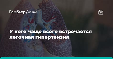 У кого чаще встречается отсутствие фотопароксизмальности?