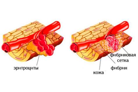 Факторы, влияющие на уровень фибриногена