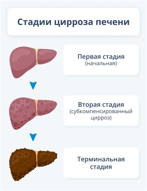 Факторы, влияющие на эхоструктуру печени у женщин