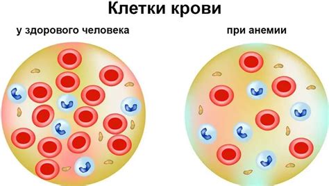 Факторы риска для развития гликированного гемоглобина у мужчин