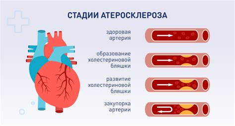 Факторы риска и предварительные симптомы