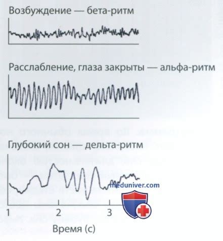 Феномен повторения одинакового сна: объяснение научной точки зрения