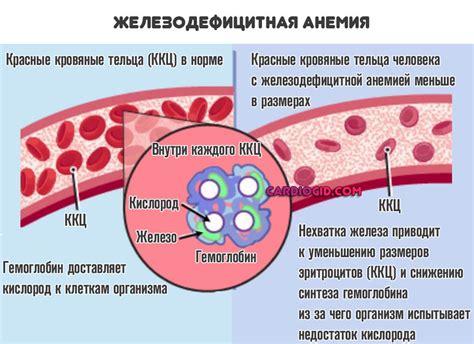 Ферритин падает: что это значит и каковы причины?