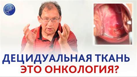 Фиброгляндулярная ткань и онкология