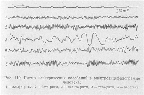 Физиологические и патологические ЭЭГ результаты