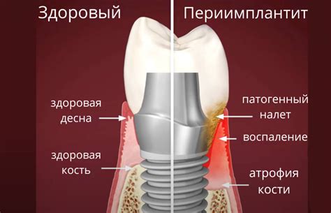 Физиологические причины снов о утрате искусственной зубной конструкции