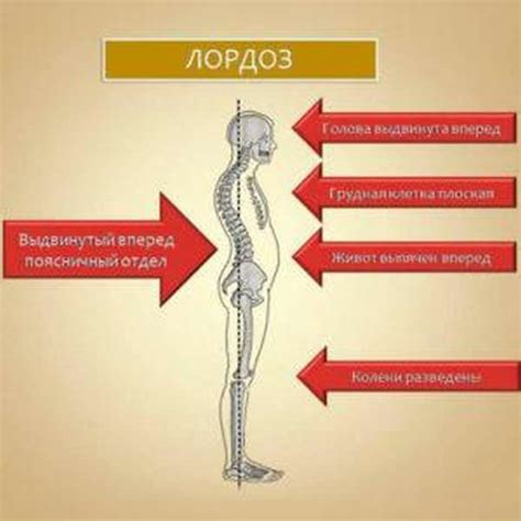 Физиологический лордоз сглажен поясничного отдела