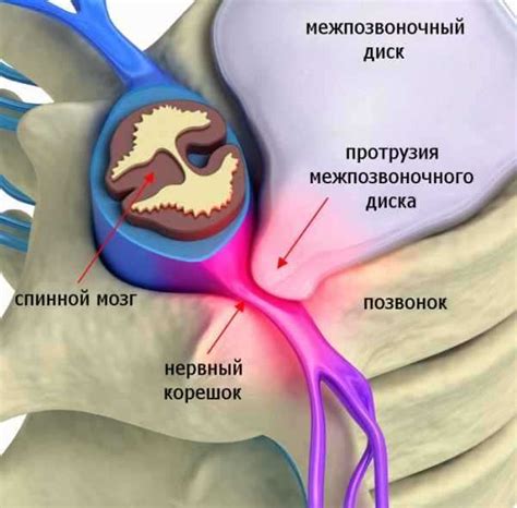 Физические причины острой торакалгии