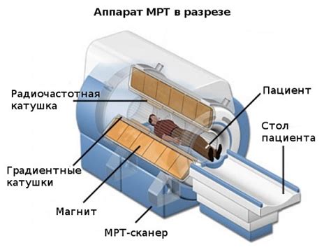 Фокальная МРТ: как работает эта технология?