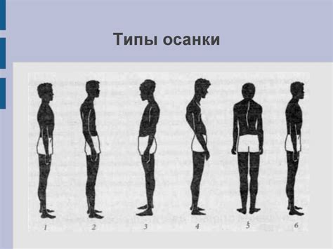 Формирование правильной осанки и элегантной походки