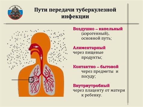 Формы и стадии туберкулеза