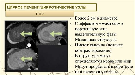 Фрагментарная визуализация печени