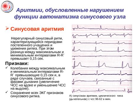 Функции регулярного синусового ритма