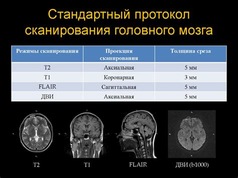 Функциональное назначение сканирования головного мозга