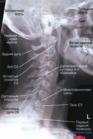 Функциональные снимки шейного отдела позвоночника