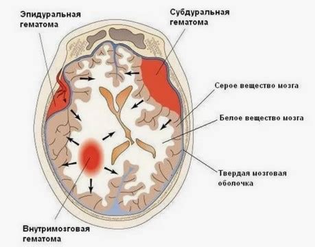 Характеристика стадии лизиса гематомы