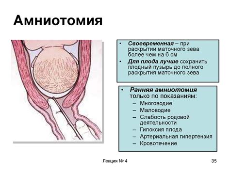 Характерные симптомы отслойки плодного пузыря