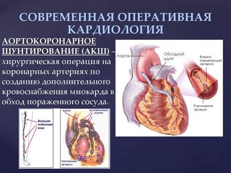 Хирургические методы лечения трепещущего сердца