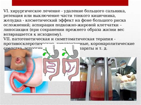 Хирургическое вмешательство при просанивании кишечника