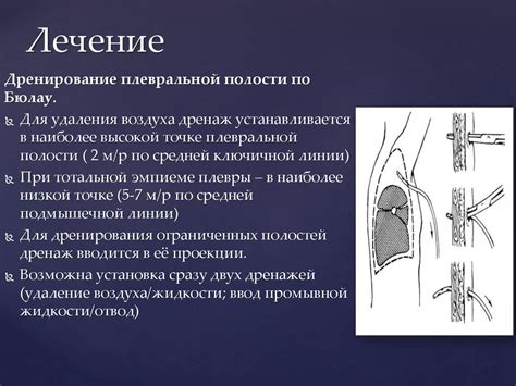 Хирургическое лечение при рвании уздечки