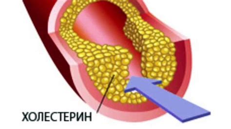 Холестерин: сущность и значение