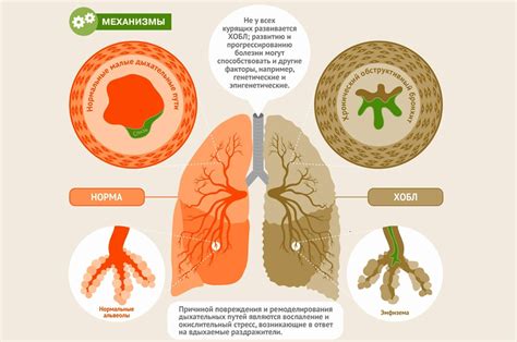 Хроническая обструктивная болезнь легких (ХОБЛ): причины и симптомы