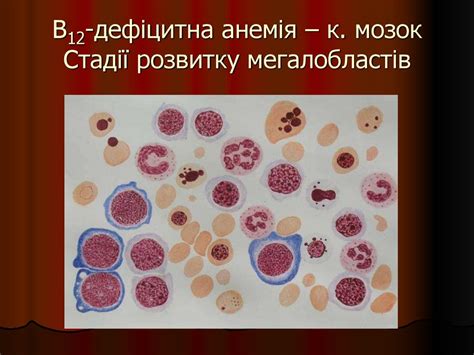 Центральна дефіцитна картина