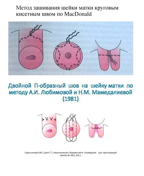 Цены и расценки зашивания человека