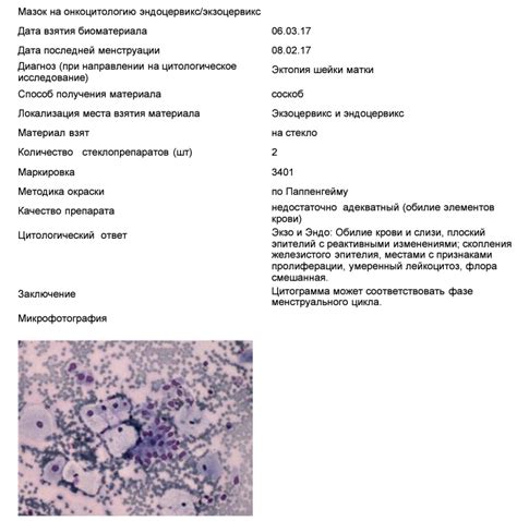 Цервикальный мазок: основные причины для проведения