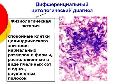 Цитологический диагноз: интерпретация и значение