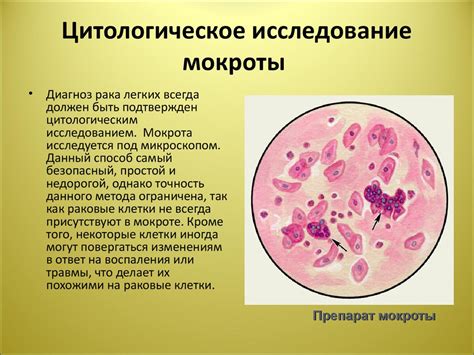 Цитологическое исследование по TBS: разбираемся в определении "удовлетворительный"