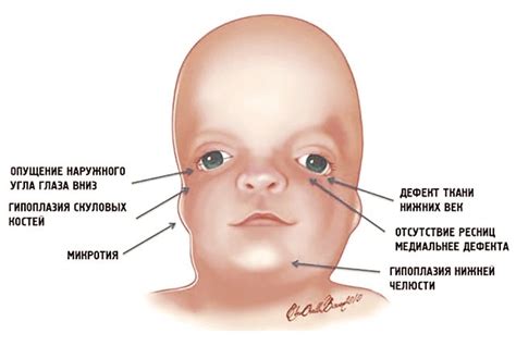 Частые симптомы трясучки