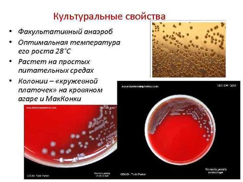 Чем отличается факультативный анаэроб от других видов микроорганизмов?