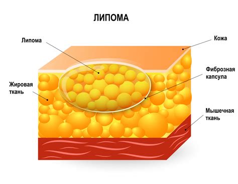 Черная слизь: причины появления и методы борьбы