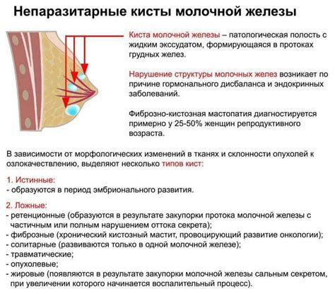 Что вызывает боль в молочных железах при менопаузе?