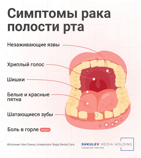 Что вызывает горение языка и горла?