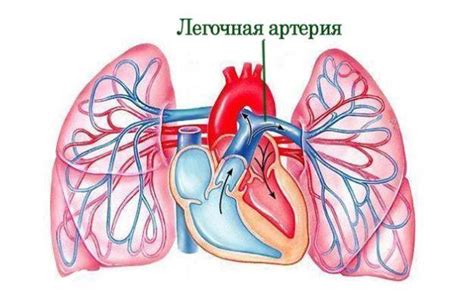 Что вызывает расширение легочной артерии?