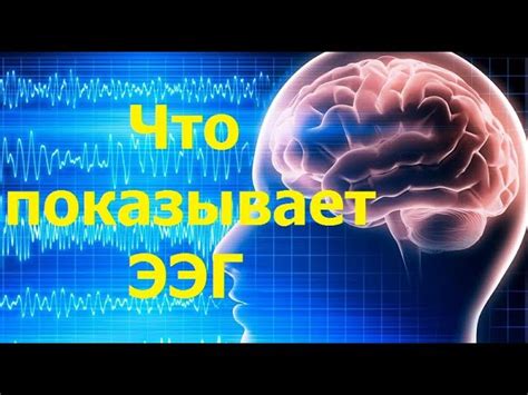 Что говорят результаты ЭЭГ