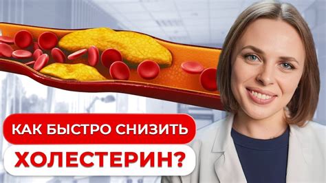 Что делать, если уровень холестерина превышает норму?