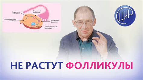 Что делать, если фолликулы не обнаружены?