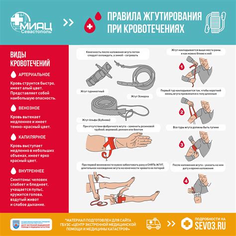 Что делать при кровотечении