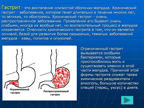 Что значит податливая слизистая?