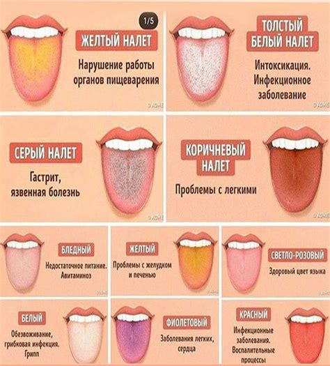 Что может вызывать зуд языка у ребенка?