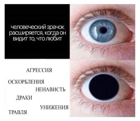 Что означает, если один зрачок меньше другого?